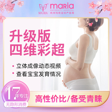 b超孕检产检孕期产前排畸 四维彩超 限单胎 杭州玛莉亚升级版
