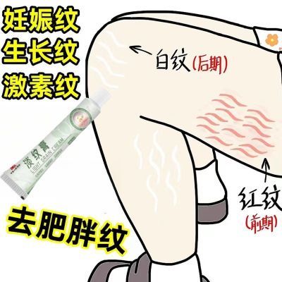 韩国去妊娠纹肥胖纹淡化大腿纹生长纹修复霜孕妇产后预防紧致专用