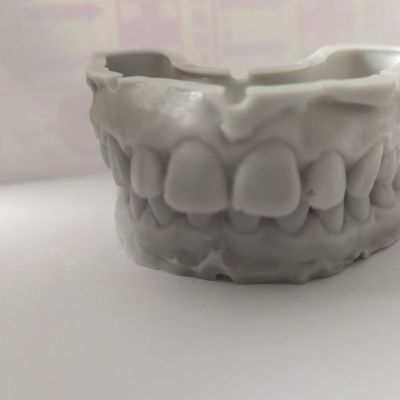 3D数字化牙模打印长期保存牙齿树脂模型石膏牙套保持器口扫描数据【15天内发货】